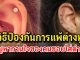 เคล็ดลับวิธีป้องกัน และแก้ไขการแพ้ต่างหู ปัญหากวนใจของคนชอบใส่ต่างหู