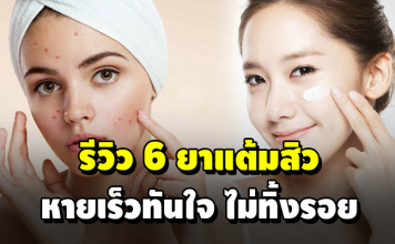 เป็นสิวได้ ก็หายได้ 6 ยาแต้มสิว หายเร็วทันใจ ไม่ทิ้งรอย