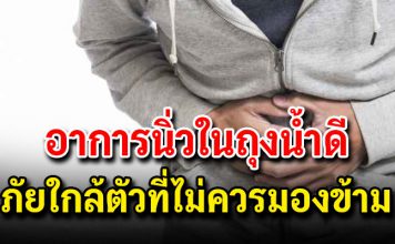 อาการ “นิ่วในถุงน้ำดี” ภัยใกล้ตัวที่ไม่ควรมองข้าม